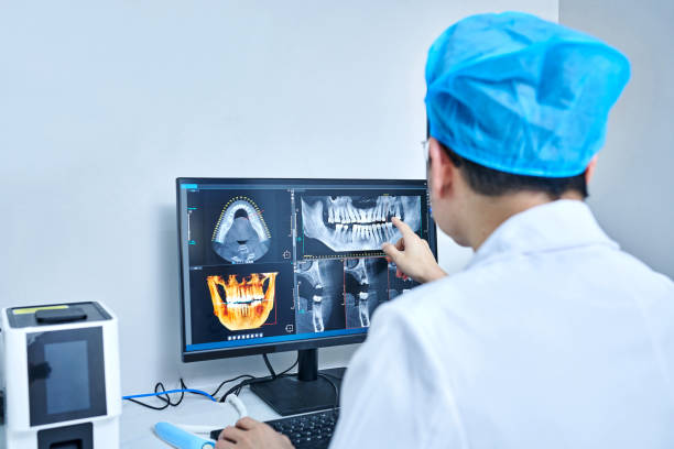 Best Knocked-Out Tooth (Avulsed Tooth) Treatment in Rayne, LA